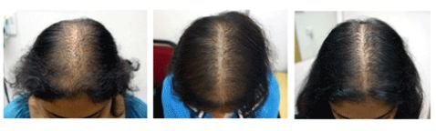 Hair growth Fertilizing temple balm for women -59ml